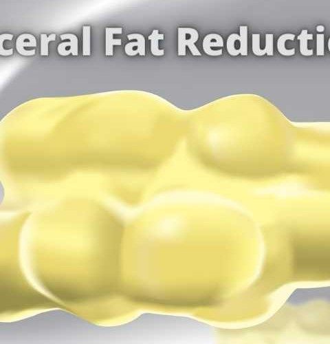 How to Reduce Visceral-fat