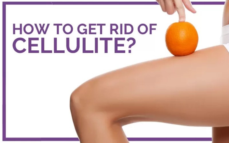 How to Prevent and Remove Cellulite